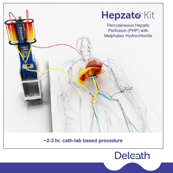 首款|HEPZATO(美法仑肝脏输送系统)美国获批治疗患有不可切除的肝脏为主的转移性葡萄膜黑色素瘤 首款|HEPZATO(美法仑肝脏输送系统)美国获批治疗患有不可切除的肝脏为主的转移性葡萄膜黑色素瘤